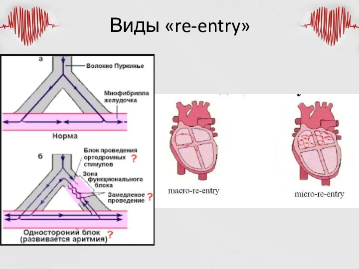 Виды «re-entry»