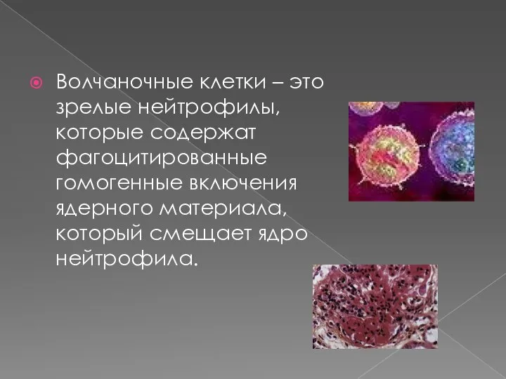 Волчаночные клетки – это зрелые нейтрофилы, которые содержат фагоцитированные гомогенные включения ядерного