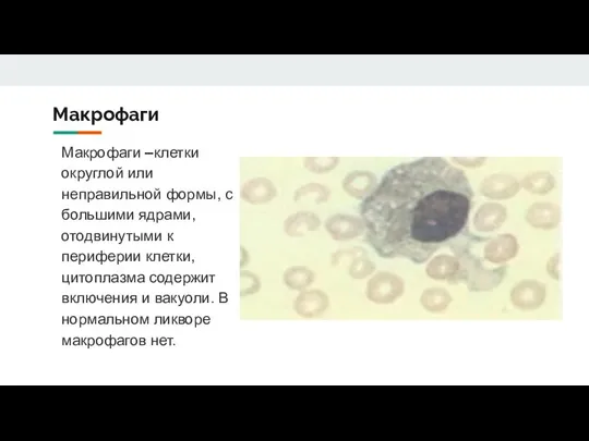 Макрофаги Макрофаги –клетки округлой или неправильной формы, с большими ядрами, отодвинутыми к