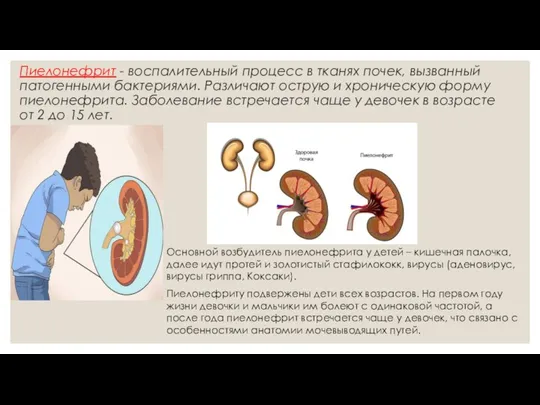 Пиелонефрит - воспалительный процесс в тканях почек, вызванный патогенными бактериями. Различают острую