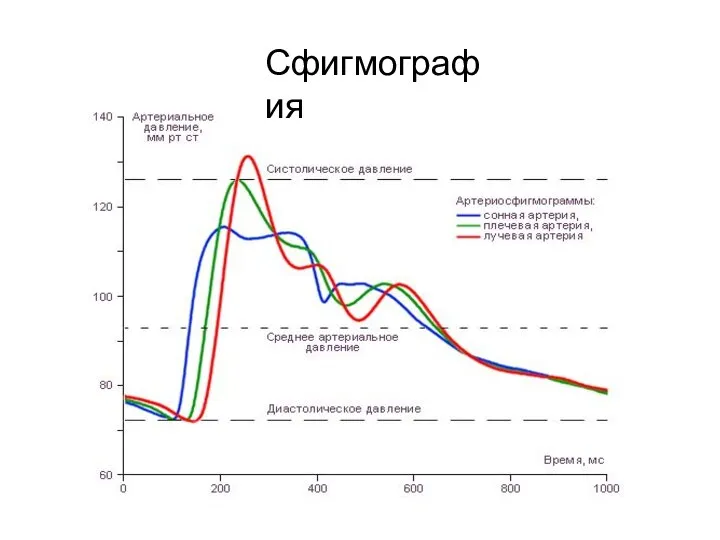 Сфигмография