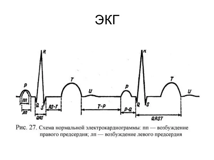 ЭКГ