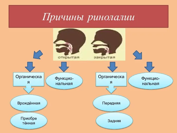 Причины ринолалии Органическая Органическая Функцио-нальная Функцио-нальная Врождённая Приобре тённая Передняя Задняя