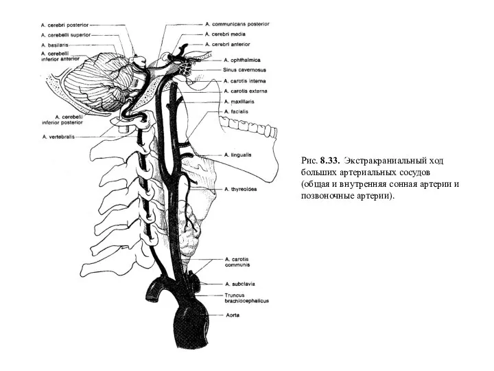 Рис. 8.33. Экстракраниальный ход больших артериальных сосудов (общая и внутренняя сонная артерии и позвоночные артерии).