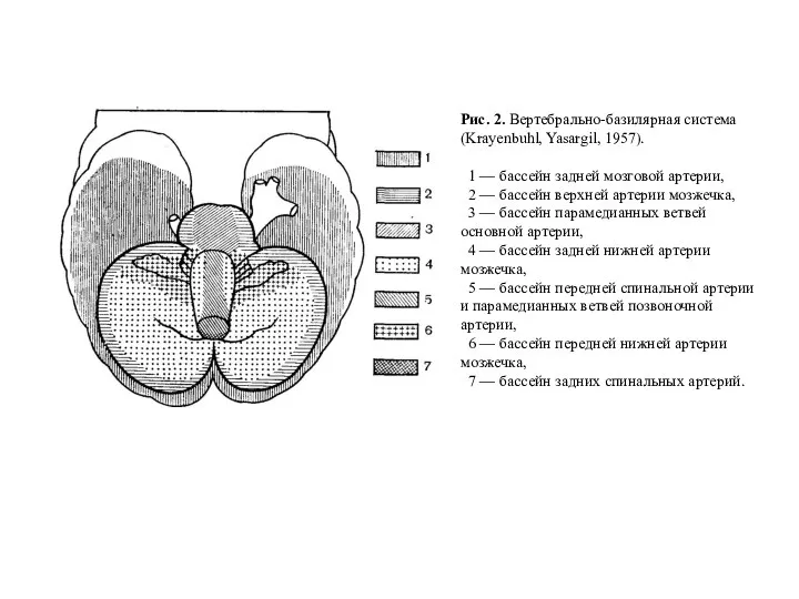 Рис. 2. Вертебрально-базилярная система (Krayenbuhl, Yasargil, 1957). 1 — бассейн задней мозговой