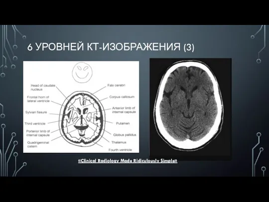 6 УРОВНЕЙ КТ-ИЗОБРАЖЕНИЯ (3) «Clinical Radiology Made Ridiculously Simple»