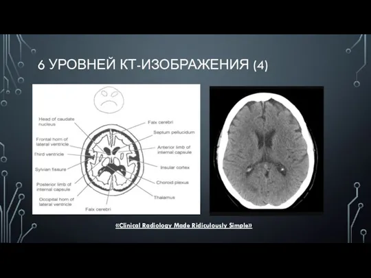 6 УРОВНЕЙ КТ-ИЗОБРАЖЕНИЯ (4) «Clinical Radiology Made Ridiculously Simple»