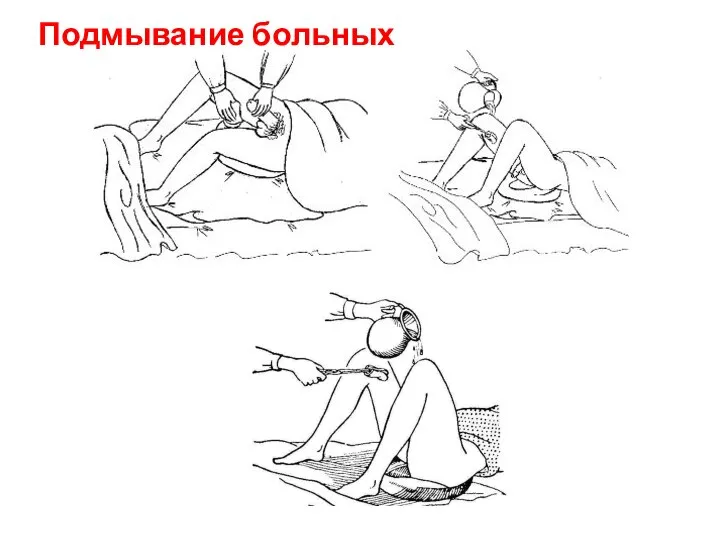 Подмывание больных