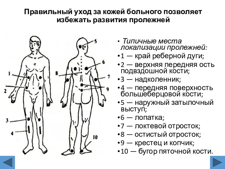 Правильный уход за кожей больного позволяет избежать развития пролежней Типичные места локализации