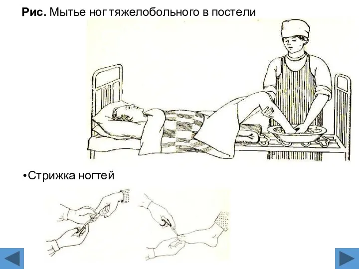 Рис. Мытье ног тяжелобольного в постели Стрижка ногтей