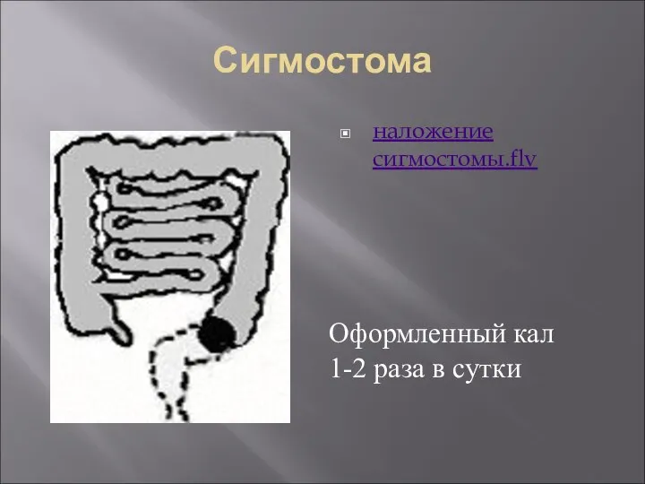 Сигмостома наложение сигмостомы.flv Оформленный кал 1-2 раза в сутки