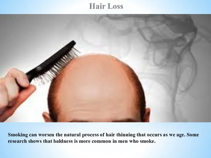 Hair Loss Smoking can worsen the natural process of hair thinning that