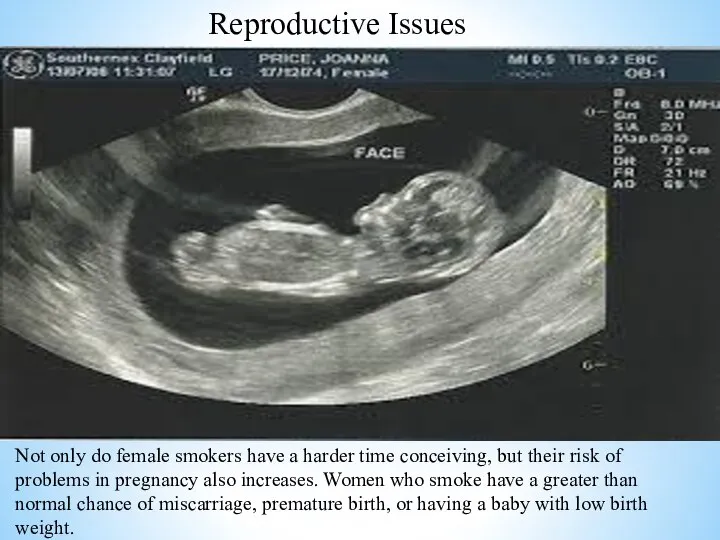 Reproductive Issues Not only do female smokers have a harder time conceiving,