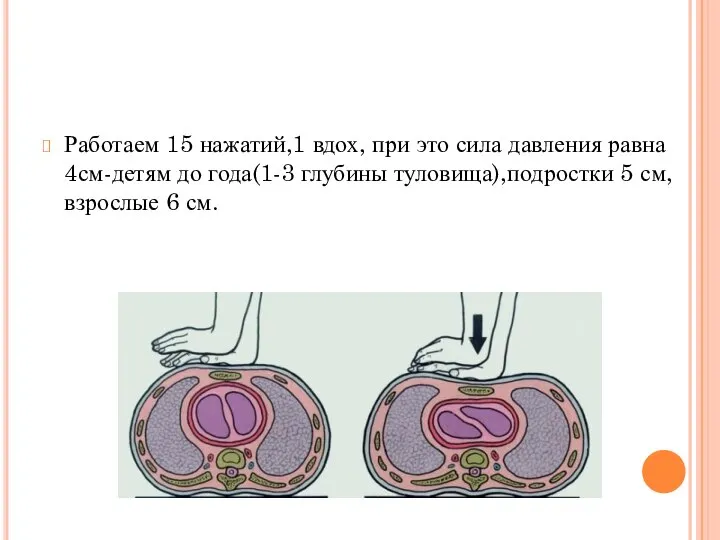 Работаем 15 нажатий,1 вдох, при это сила давления равна 4см-детям до года(1-3