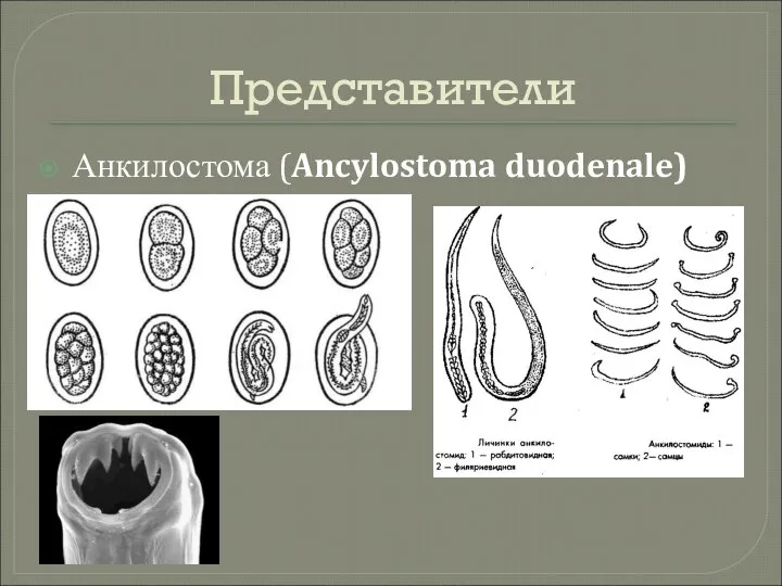 Представители Анкилостома (Ancylostoma duodenale)