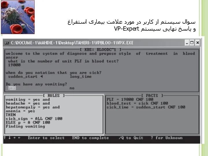 سوال سیستم از کاربر در مورد علامت بیماری استفراغ و پاسخ نهایی سیستم VP-Expert