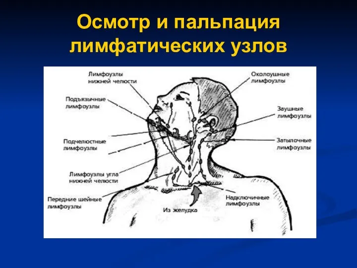 Осмотр и пальпация лимфатических узлов