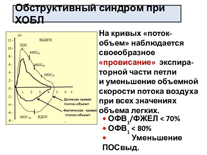 Обструктивный синдром при ХОБЛ • ОФВ1/ФЖЕЛ • ОФВ1 • Уменьшение ПОСвыд. На