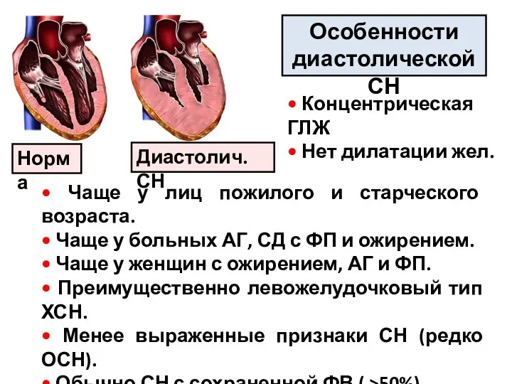 Особенности диастолической СН Норма Диастолич. СН • Чаще у лиц пожилого и