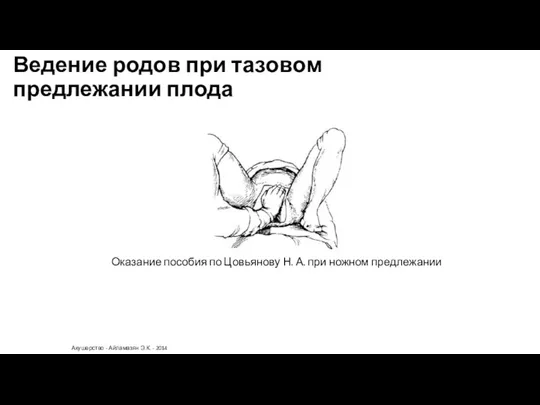 Ведение родов при тазовом предлежании плода Оказание пособия по Цовьянову Н. А.