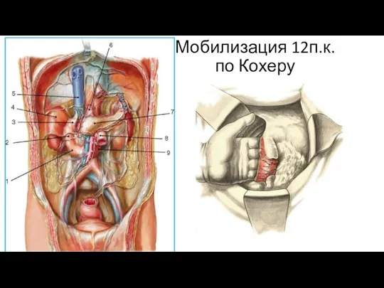 Мобилизация 12п.к. по Кохеру