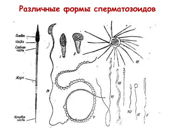 Различные формы сперматозоидов