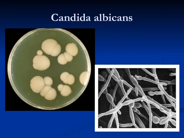 Candida albicans