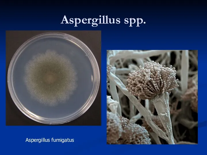 Aspergillus spp. Aspergillus fumigatus