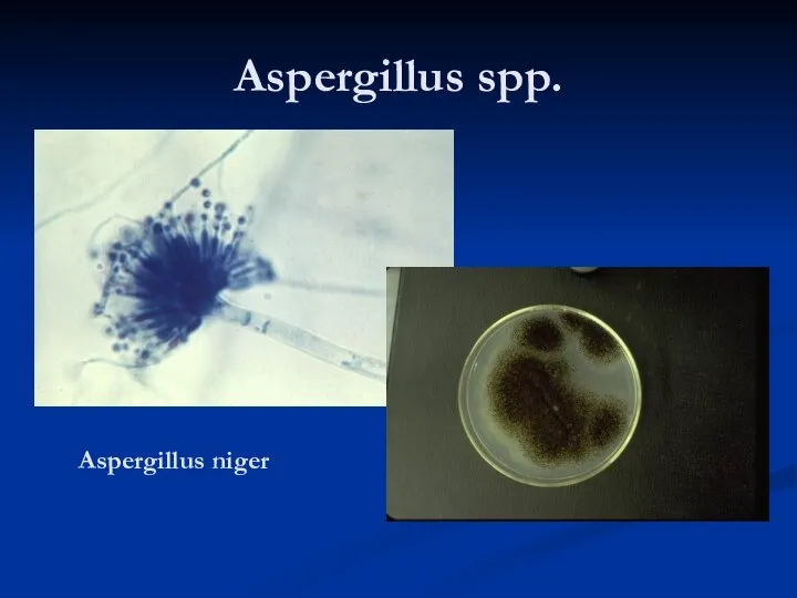 Aspergillus spp. Aspergillus niger