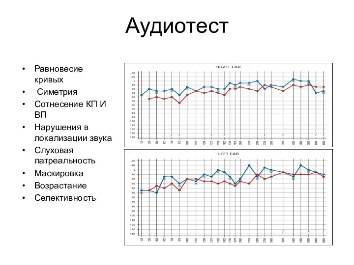 Аудиотест Равновесие кривых Симетрия Сотнесение КП И ВП Нарушения в локализации звука