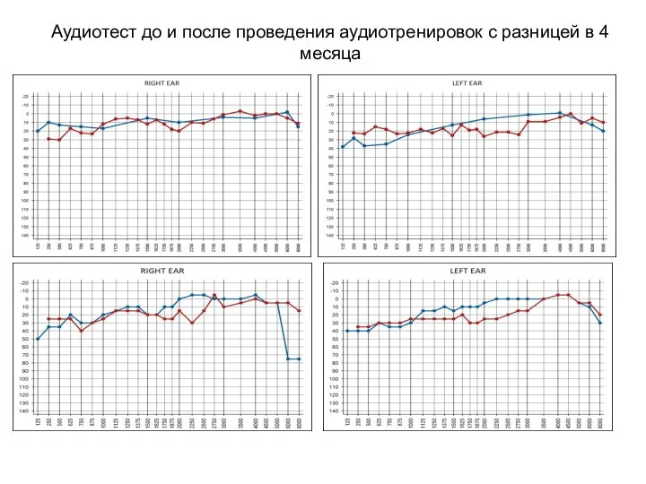 Аудиотест до и после проведения аудиотренировок с разницей в 4 месяца