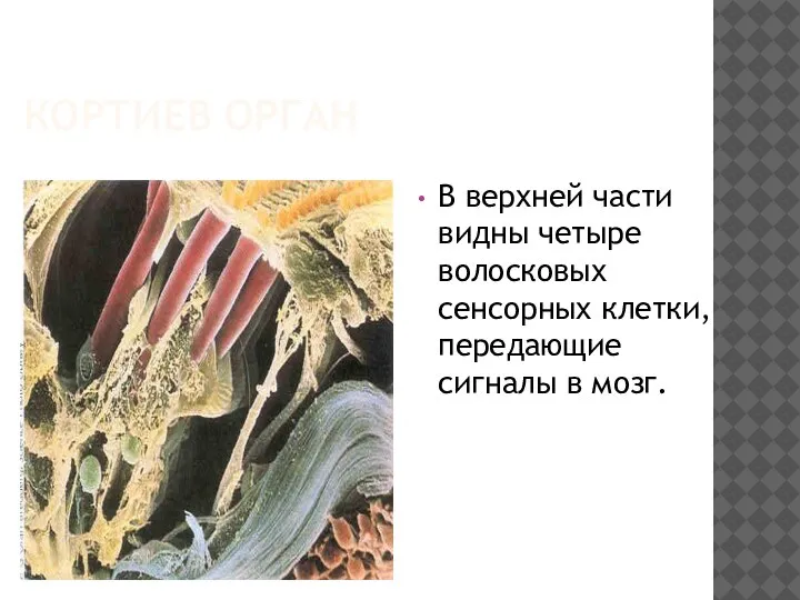 КОРТИЕВ ОРГАН В верхней части видны четыре волосковых сенсорных клетки, передающие сигналы в мозг.