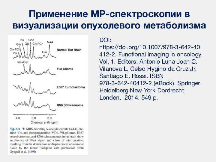 Применение МР-спектроскопии в визуализации опухолевого метаболизма DOI: https://doi.org/10.1007/978-3-642-40412-2. Functional imaging in oncology.