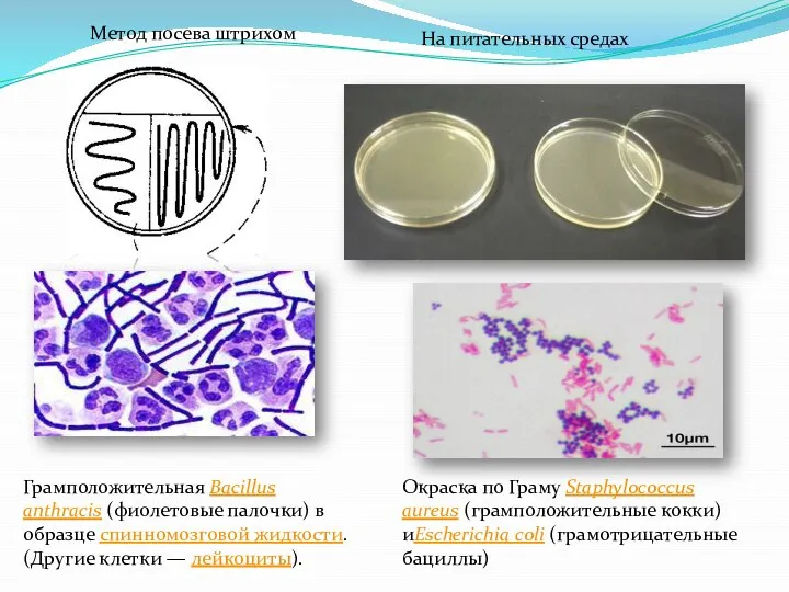 Метод посева штрихом На питательных средах Грамположительная Bacillus anthracis (фиолетовые палочки) в