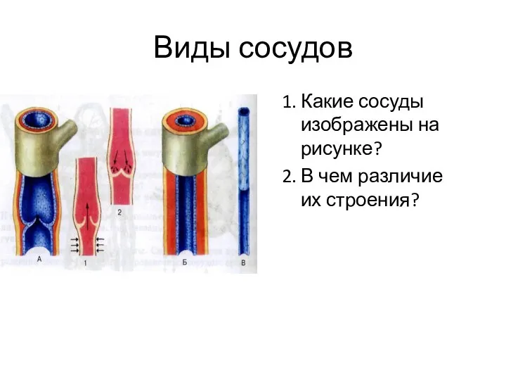 Виды сосудов 1. Какие сосуды изображены на рисунке? 2. В чем различие их строения?