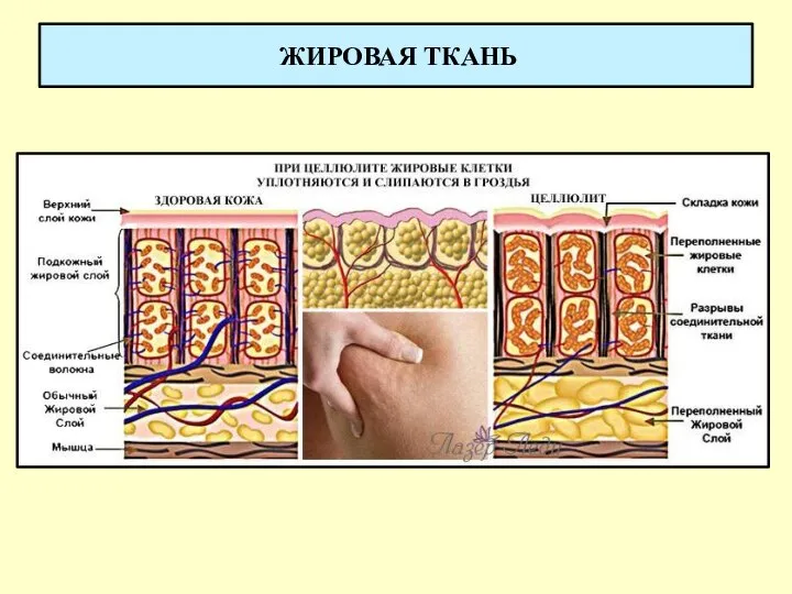 ЖИРОВАЯ ТКАНЬ