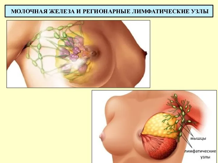 МОЛОЧНАЯ ЖЕЛЕЗА И РЕГИОНАРНЫЕ ЛИМФАТИЧЕСКИЕ УЗЛЫ