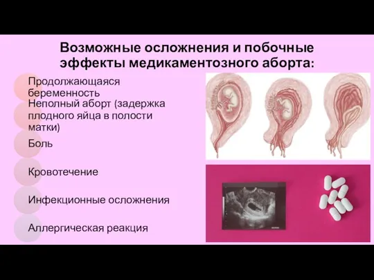 Возможные осложнения и побочные эффекты медикаментозного аборта: