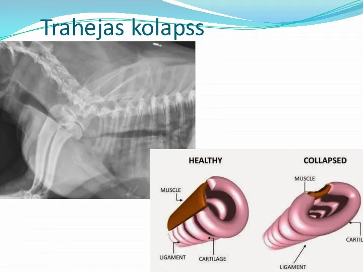 Trahejas kolapss