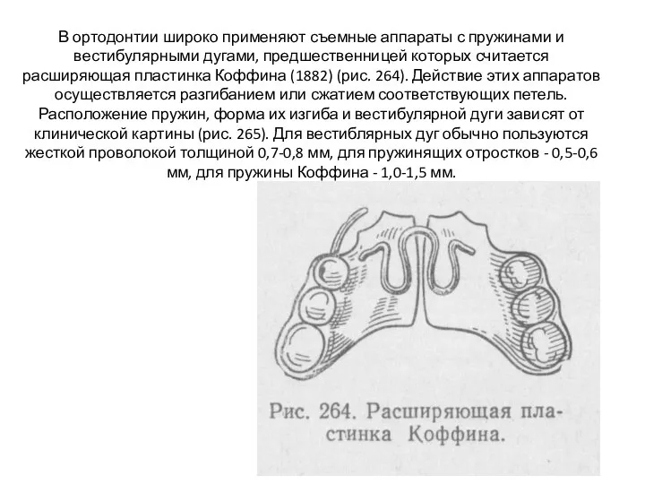 В ортодонтии широко применяют съемные аппараты с пружинами и вестибулярными дугами, предшественницей