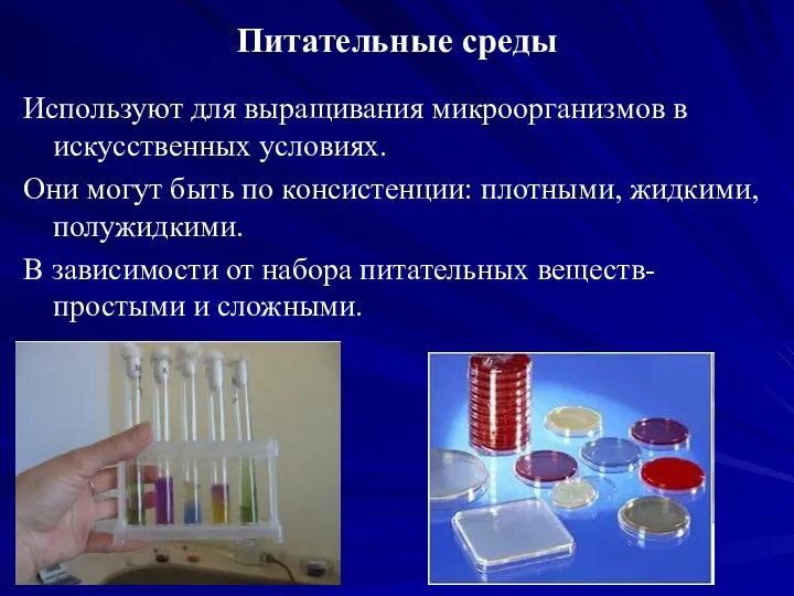 Питательные среды Используют для выращивания микроорганизмов в искусственных условиях. Они могут быть