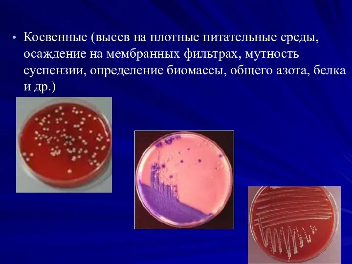 Косвенные (высев на плотные питательные среды, осаждение на мембранных фильтрах, мутность суспензии,