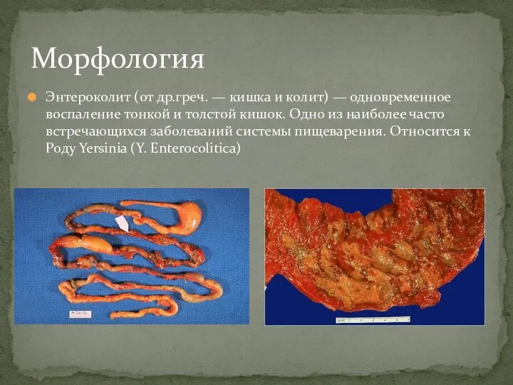 Энтероколит (от др.греч. — кишка и колит) — одновременное воспаление тонкой и