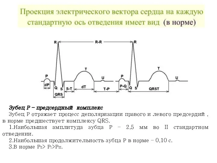 Зубец Р – предсердный комплекс Зубец Р отражает процесс деполяризации правого и