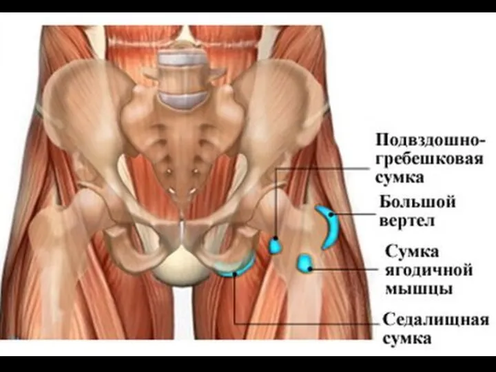 Здоровый сустав Начальные изменения Выраженные изменения Конечная стадия