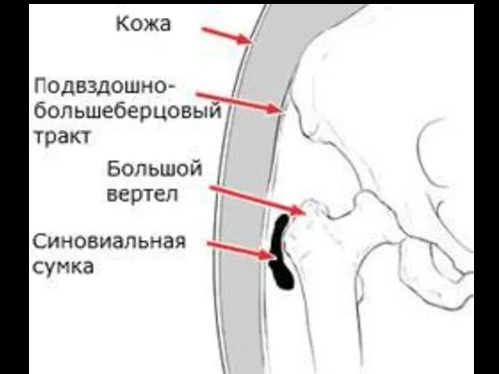 Здоровый сустав Начальные изменения Выраженные изменения Конечная стадия