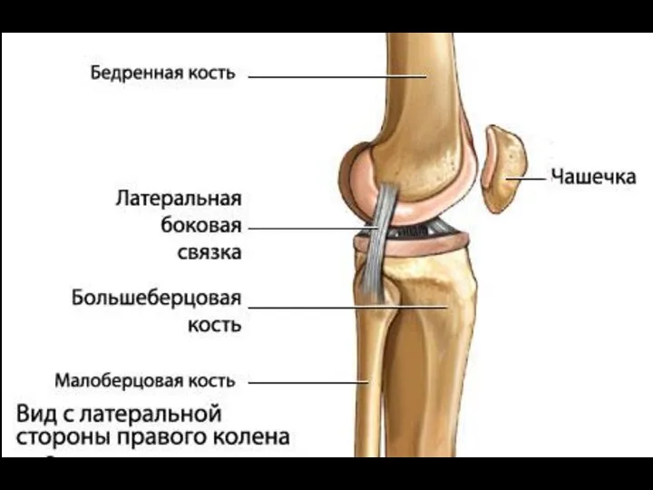 Здоровый сустав Начальные изменения Выраженные изменения Конечная стадия