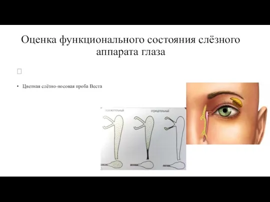 Оценка функционального состояния слёзного аппарата глаза  Цветная слёзно-носовая проба Веста