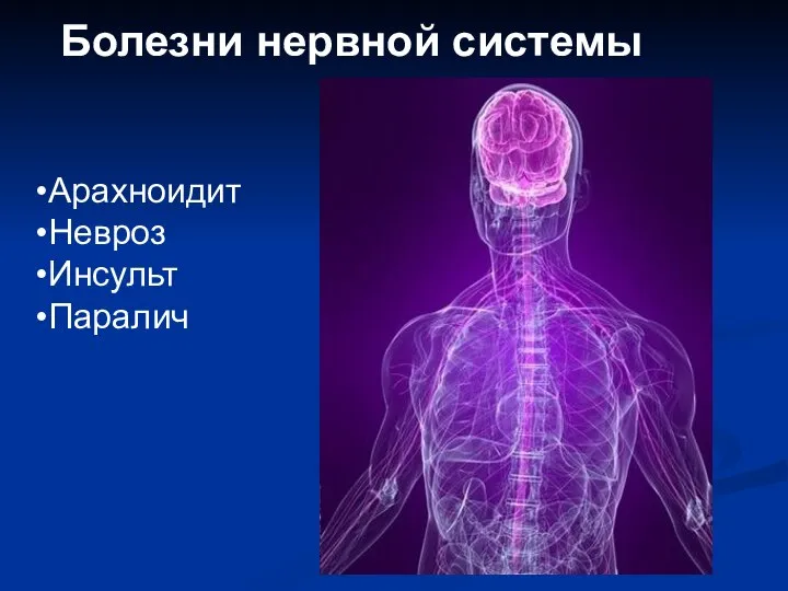 Болезни нервной системы Арахноидит Невроз Инсульт Паралич