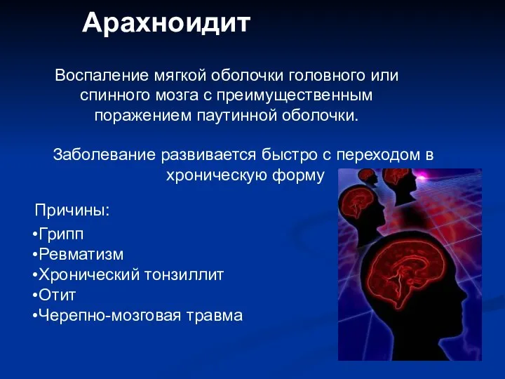 Арахноидит Воспаление мягкой оболочки головного или спинного мозга с преимущественным поражением паутинной